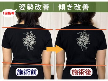 レシカ/姿勢改善で体の傾きや左右差改善