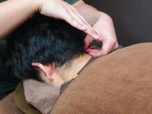 エイチスリー 武蔵小杉院/鍼灸＋マッサージコース