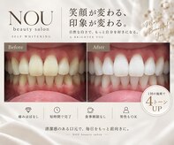 ノウ (NOU)