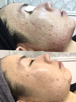 ステラルーテ(Stella lute)/凹凸もなめらかに