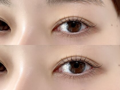 ジューシーアイ 成増店(Juicy Eye)の写真