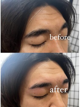 サムライビューティー 西新宿本店(SamuraiBeauty)/ボサ眉からモテ眉へ♪
