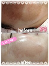 ソーハート(So Heart)/大人気！美肌エイジングに特化☆