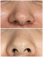 ギャラクシービューティー(galaxy beauty)/プラズマのパワー！