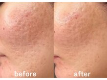 ホワイトアクア 鹿児島店(WHITE AQUA)/ララピール/鹿児島ララピール