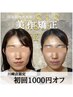 【プロ施術で整える】国家資格者による小顔矯正 ¥16,600