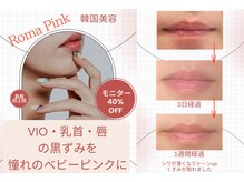 黒ずみにお悩みの方・今話題！最先端の肌ケア【ローマピンク】