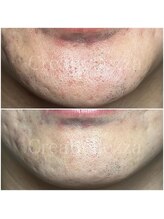 クレアベレッツァ(Crea Bellezza)/剃刀負けしやすい肌にも◎