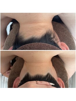 ミース 北九州店/うなじ◎ビフォーアフター