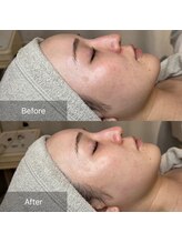 大人女子のためのたるみ改善サロン　Charmant【シャルマン】/