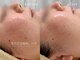 ルコァドゥ(rucor doux)の写真