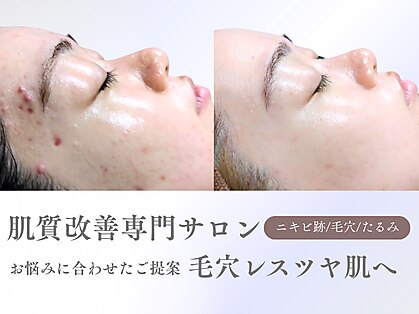 ハーティの写真