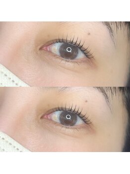 ミー(Me)の写真/目元美容は女性が一番可愛く綺麗になれる幸せの方法!似合わせデザイン得意!正面・真横どこから見ても綺麗☆