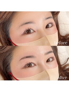 ダリ(Dali)/ハリウッドブロウリフト