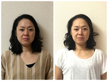 フィシス/40代以上の方に好評！<小顔矯正>