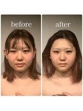 グレースフィオーレ 町田店(gracefiore)/ビフォーアフター/施術1回の効果