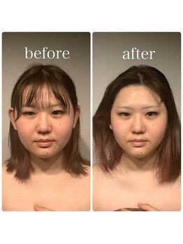 グレースフィオーレ 町田店(gracefiore)/ビフォーアフター/施術1回の効果