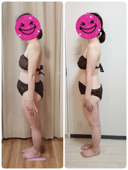 ヨサパーク アーリア(YOSA PARK arya)/まだ１ヶ月ですが変化出てる♪