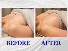 ザモア 福岡天神(THE MORE)/【症例 Before After】