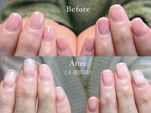 自爪育成メニューで指先のお悩みも改善◎