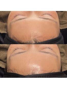 トイロ(toiro)/肌が変わるララピール