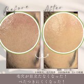 モアトゥインクル 福山宮通り店(MORE twinkle)