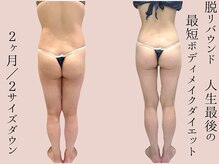 シェリートーキョー 成田店(Cherie Tokyo)