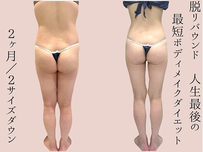 シェリートーキョー 成田店(Cherie Tokyo)の写真