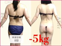 ココア整体 岐阜店(cocoa整体)/最新痩身マシン/脂肪燃焼リンパ