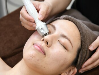 ビオラス 太田藤阿久店/小顔矯正でスッキリした輪郭へ！