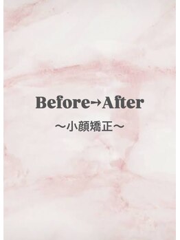 ボディヒーリングアンド小顔美容矯正 プララン/小顔矯正ビフォーアフター★