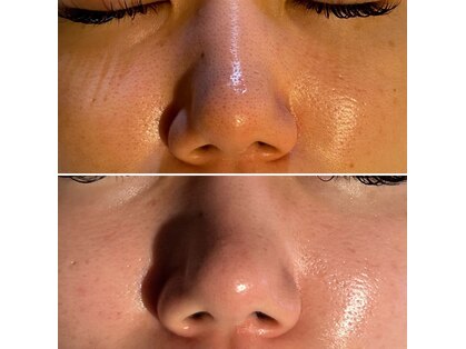 レアリゼ(Realiser)の写真