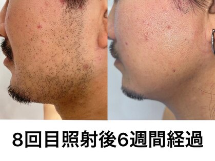 イエナ(IENA)の写真