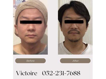 ヴィクトワール(Victoire)の写真