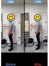 サンライズ鍼灸整骨院 淀屋橋院/猫背矯正