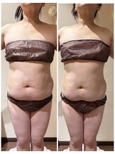 マハロ スコータイ/ビフォーアフター　＜お腹＞