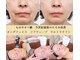 ナチュレアンドメディカ(Nature&Medica)の写真/★価格・効果の満足度全国1位★もはやオペ級！今世紀最後、最強のたるみ改善で自分史上最高のリフトアップ