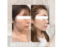 ファビュラス ビューティー(Fabulous Beauty)の雰囲気（世界一のたるみケア！最先端技術！）