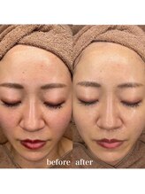 ルミナス(Luminous)/ララピール