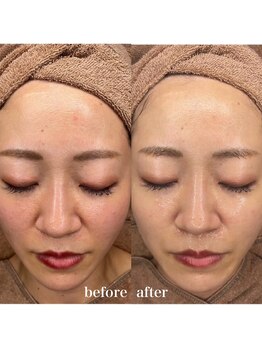 ルミナス(Luminous)/ララピール