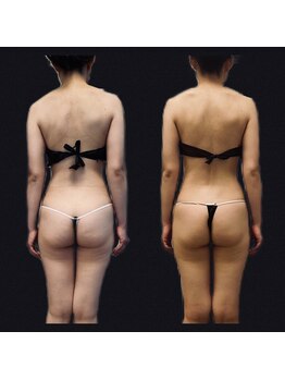 リタザビューティー(RITA THE BEAUTY Parsonal Beauty Studio)/ChinoTHE METHOD美骨luxury