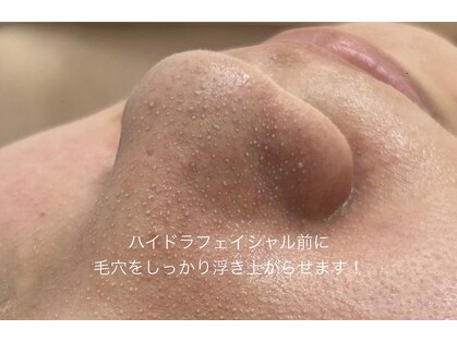 キアラ(CHIARA)の写真