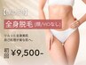【人気No.2★レディース脱毛】全身脱毛(顔/VIO無し) 初回12,000円→9,500円
