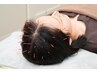 【脳疲労回復・頭痛に◎】全身オーダーメイド鍼灸80分 ¥12700