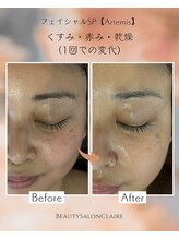 クレール(Claire)/【フェイシャルSP】目元くすみ