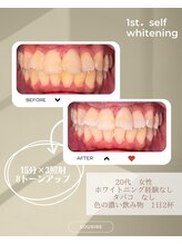 スリール(sourire)/ビフォーアフター