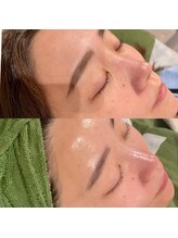 ベル(belle)/ノーファンデが叶う艶肌