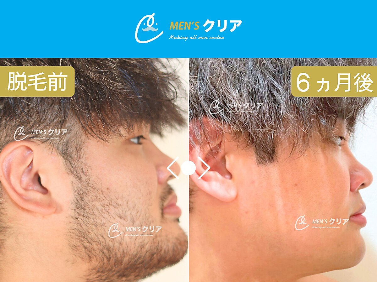 メンズクリア 愛媛松山店｜ホットペッパービューティー