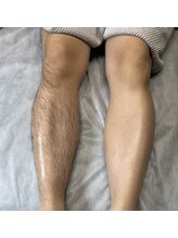 ブラジリアンワックスアンドマツエク グルック/ダブル脱毛