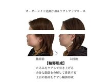 エステビジン 富山店(エステBIZIN)の雰囲気（施術３回★小顔マシン３つを組み合わせ大幅変化を追求してます♪）